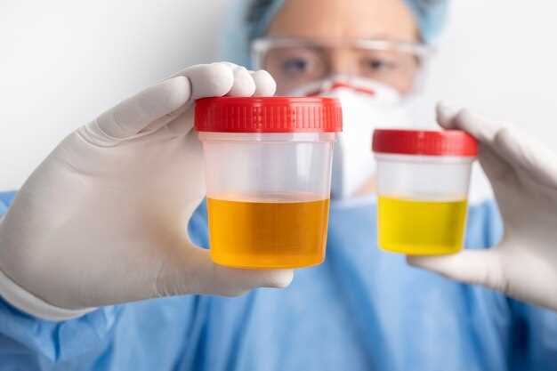 Does methocarbamol show up in urine test