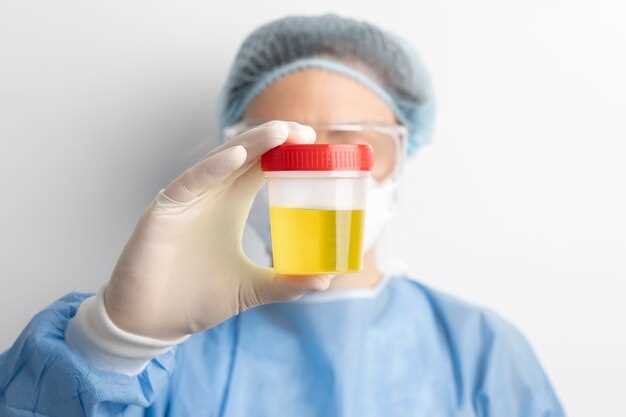 Will methocarbamol show up in a urine test